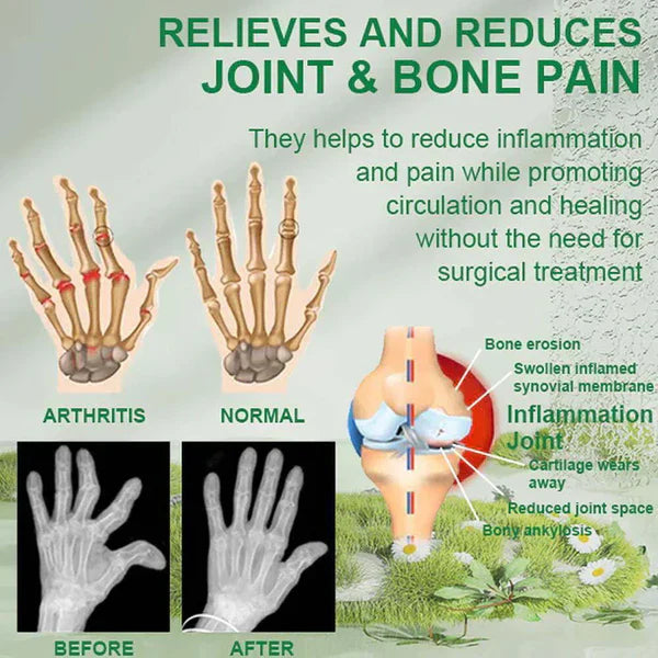 Bee Venom Joint and Bone Therapy Cream (Pack of 2)